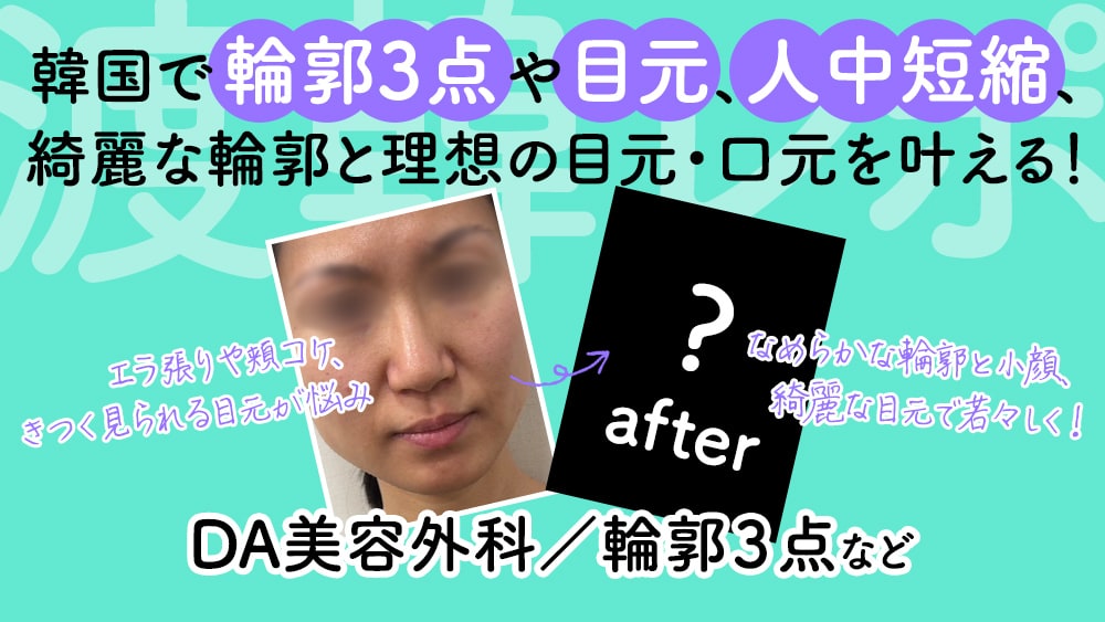 DA美容外科で輪郭3点や目元、人中短縮など綺麗な輪郭と理想の目元・口元を叶える！【渡韓美容整形レポ：vol.7】