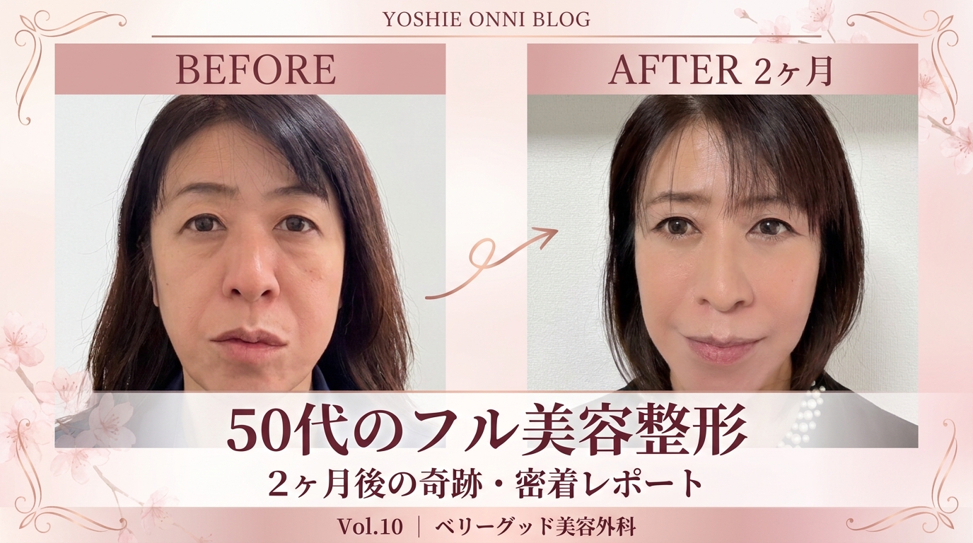 50代のフル美容整形・2ヶ月後の奇跡｜ベリーグッド美容外科・密着レポート