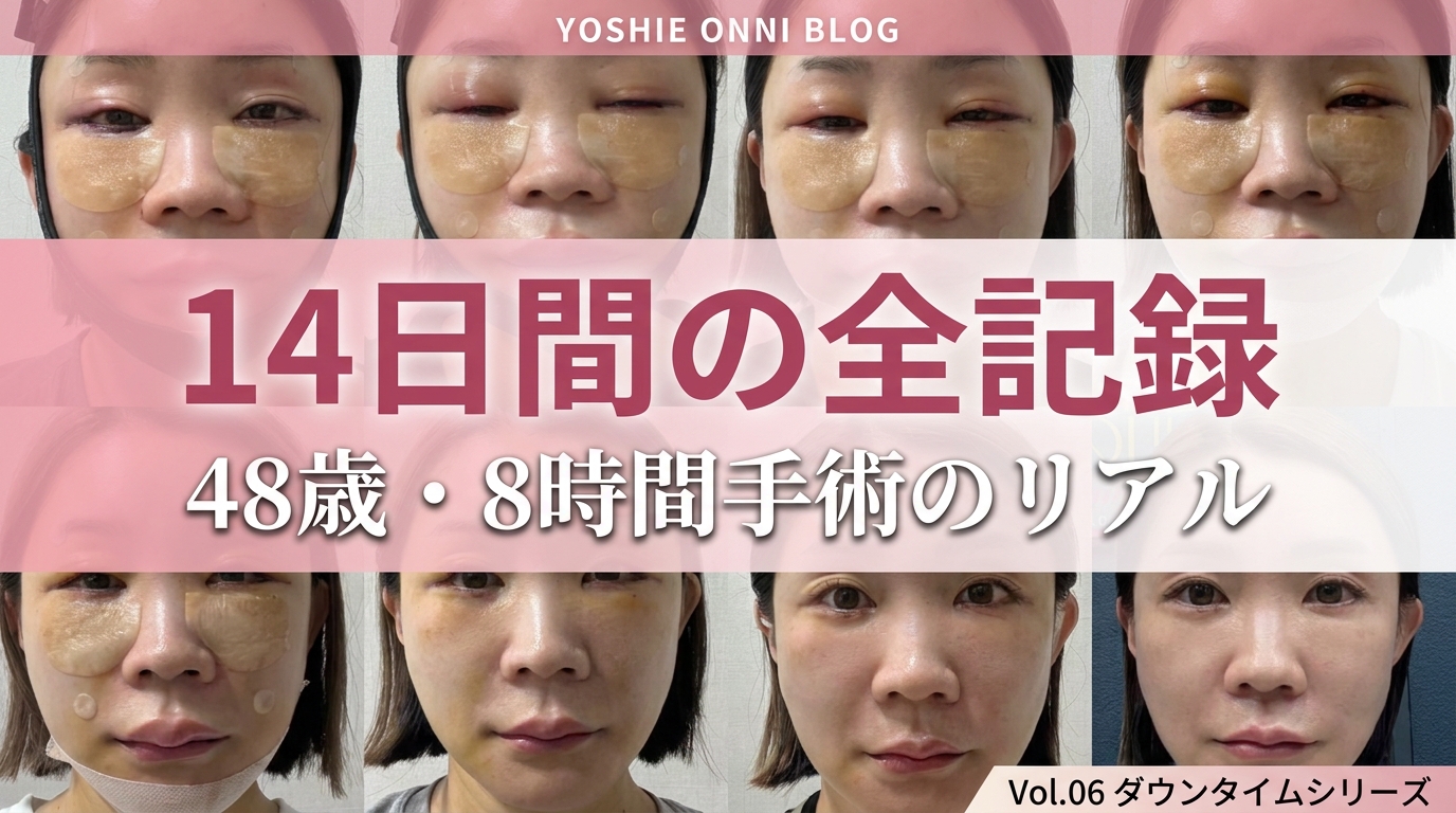 【ダウンタイムシリーズ】8時間手術・14日間の全記録｜48歳カウンセラーが自ら体験したリアル