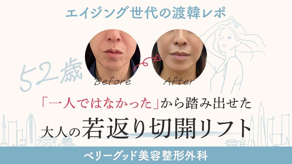 52歳、「一人ではなかった」から踏み出せた大人の若返り切開リフト<br>【エイジング世代の韓国美容整形モニターReport vol.1】