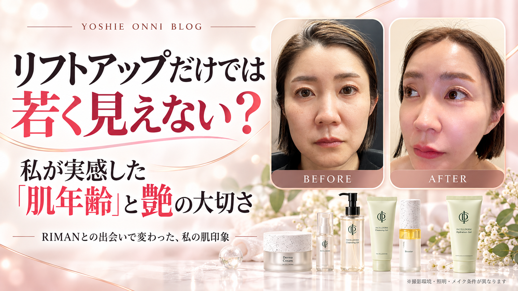 リフトアップだけでは若く見えない？私が実感した「肌年齢」と艶の大切さ